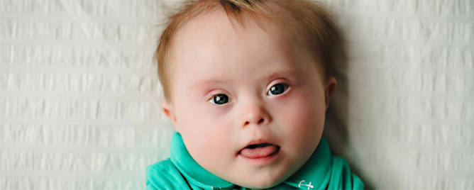 <br>Compared a new genetic animal model of Down syndrome to the standard model and found the updated version to be more similar to the changes seen in humans.....<a href='https://www.genome.gov/news/news-release/researchers-study-enhanced-genetic-animal-model-of-down-syndrome' target='_blank'>More</a>